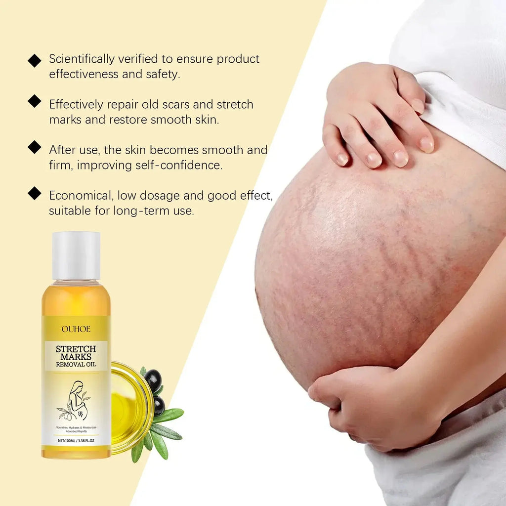 Stretch Mark Lightening Essential Oil Skin Care Cream for Pregnant Women Moisturizing Lifting Firming Skin Slimming Oil 100ml