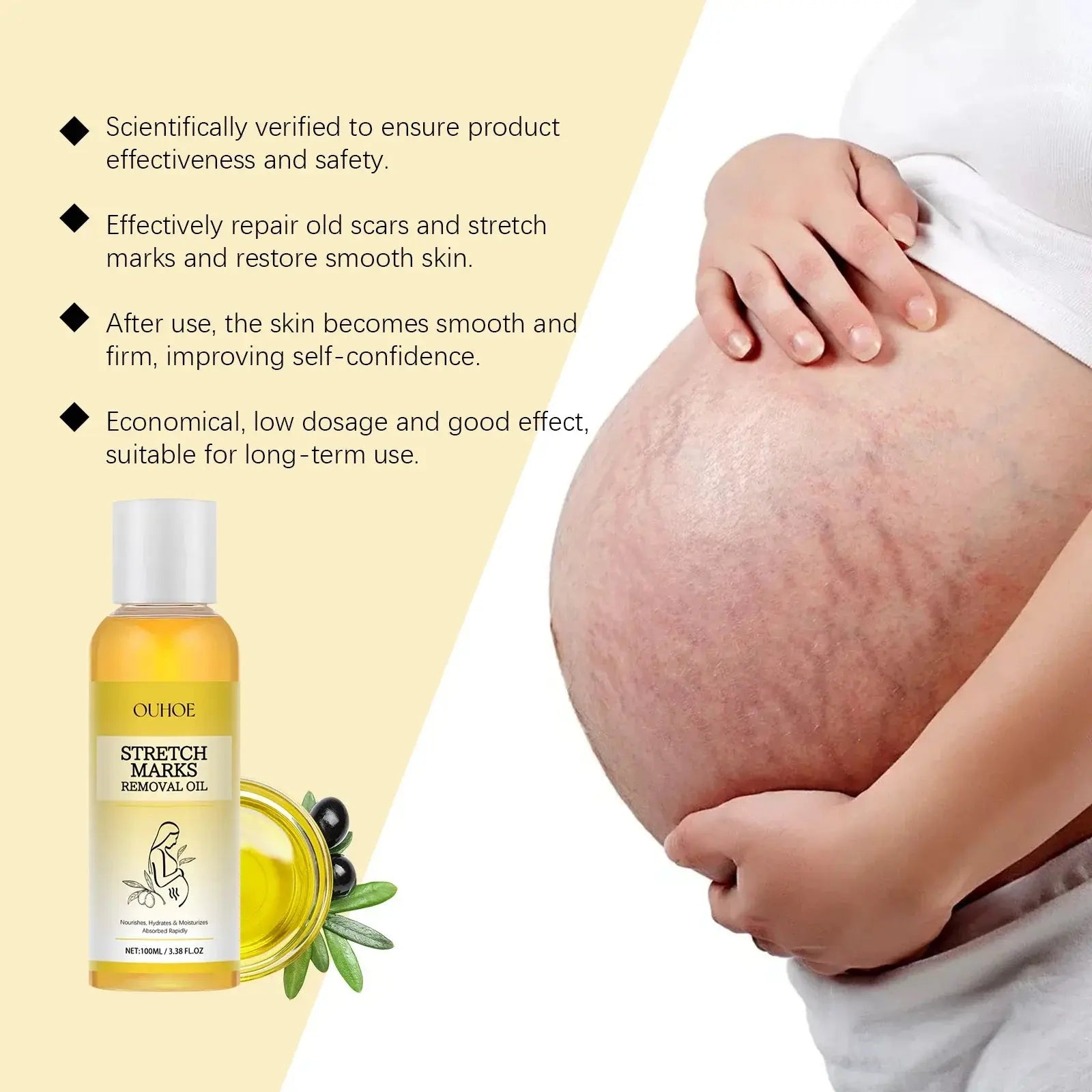Stretch Mark Lightening Essential Oil Skin Care Cream for Pregnant Women Moisturizing Lifting Firming Skin Slimming Oil 100ml