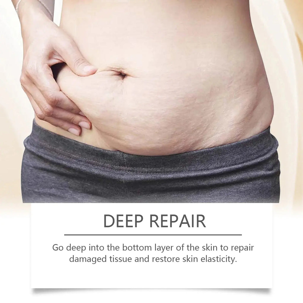 Stretch Mark Lightening Essential Oil Skin Care Cream for Pregnant Women Moisturizing Lifting Firming Skin Slimming Oil 100ml