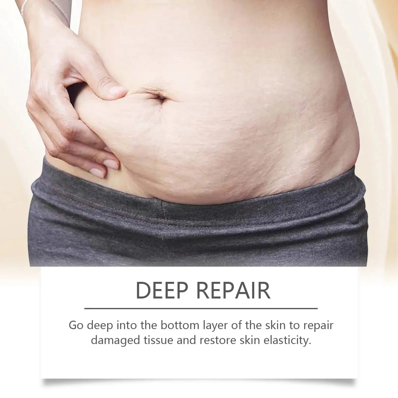 Stretch Mark Lightening Essential Oil Skin Care Cream for Pregnant Women Moisturizing Lifting Firming Skin Slimming Oil 100ml